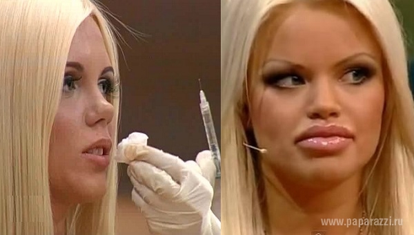 Страшно красивые: 5 девушек, которые стали популярны благодаря фотошопу и пластическим операциям - Олеся Малибу (до и после пластики)