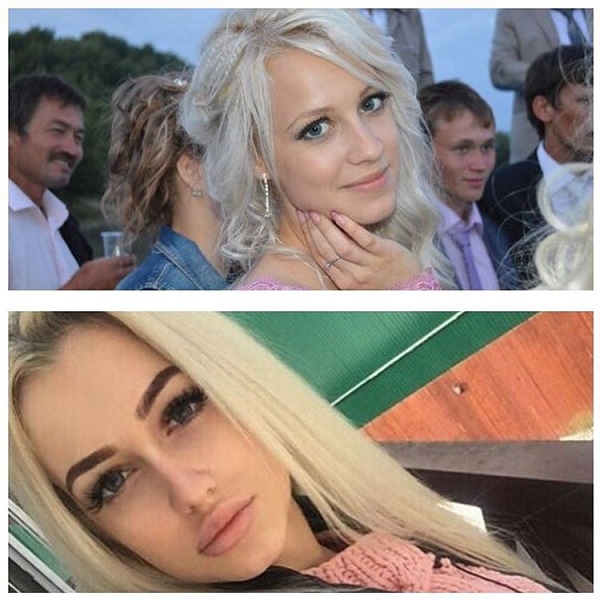 Опубликованы фото до и после пластических вмешательств Екатерины Гужвинской
