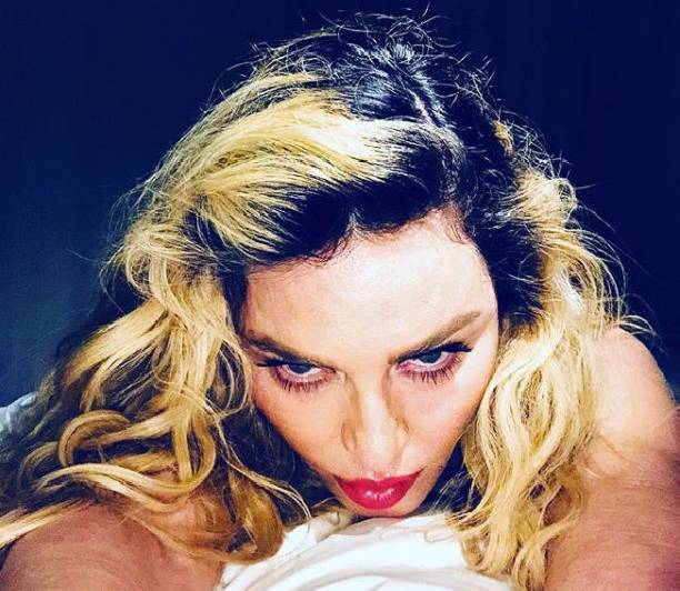 Мадонна ужаснула фанатов перетянутым лицом