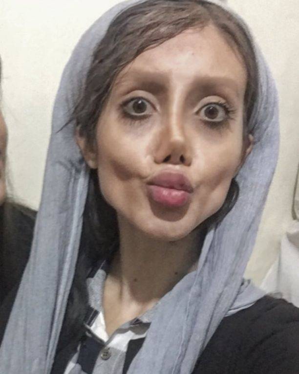 Иранка сделала 50 пластических операций, чтобы стать похожей на Джоли