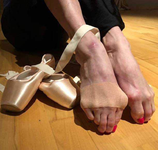 Анастасия Волочкова ужаснула окровавленными ногами