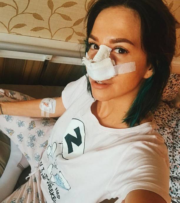 Натали Неведрова перенесла пластическую операцию