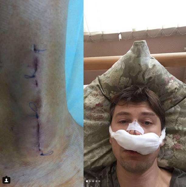 Алексей Ягудин ужаснул снимком из больницы