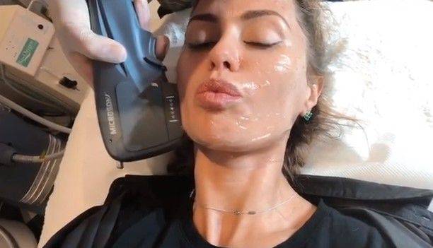 Виктория Боня засняла на видео болезненную процедуру уменьшения овала лица