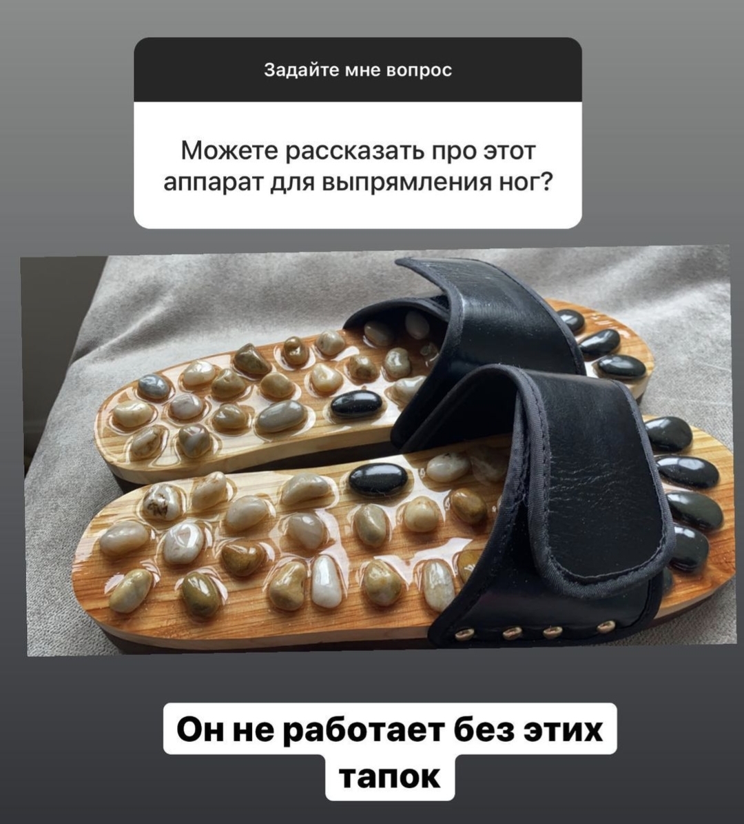 "Выпрямила свои кривые ноги этим аппаратом": Алёна Шишкова разместила фото необычного устройства