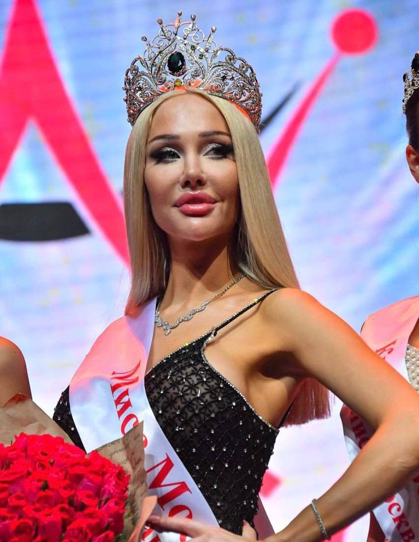 Новой «Мисс Москва» стала резиновая Зина, то есть Ангелина Бреженская, из Саратова. ТОП 10 фото Ангелины Бреженской, спонсор которой не скупится на пластику