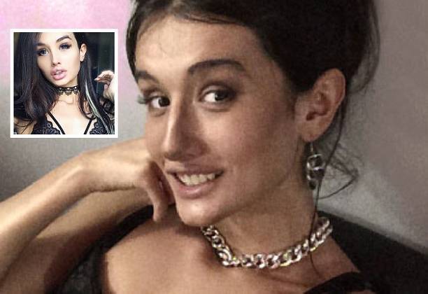 Марина Мексика показала фото после пластики носа