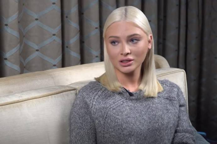«Слёзы и отёк»: Алёна Шишкова показала, как выглядела после родов «Слёзы и отёк»: Алёна Шишкова показала, как выглядела после родов