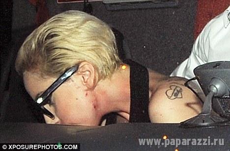 Lady GaGa от усталости покрылась прыщами Lady GaGa от усталости покрылась прыщами