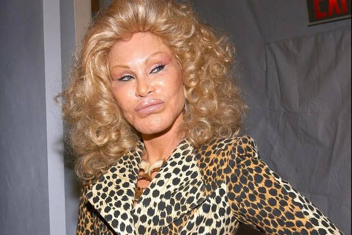 Как сейчас выглядит 82-летняя женщина-кошка Джослин Вильденштейн Как сейчас выглядит 82-летняя женщина-кошка Джослин Вильденштейн