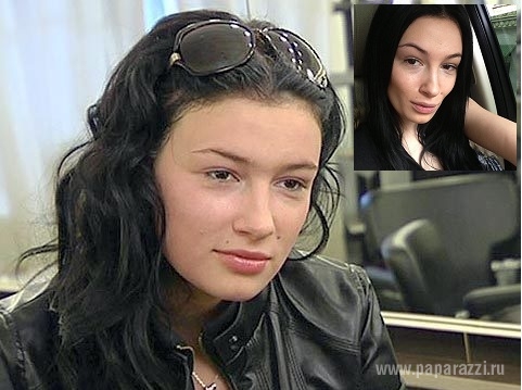Анастасия Приходько изуродовала себя диетой