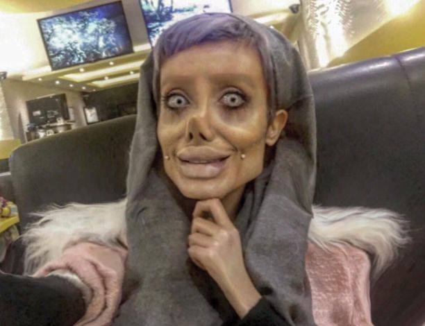 Иранка сделала 50 пластических операций, чтобы стать похожей на Джоли