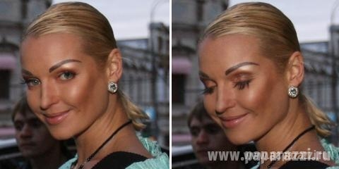 На что готовы звезды ради красоты? На что готовы звезды ради красоты?