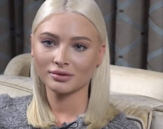 Алёна Шишкова сделала очередную пластику и теперь её не узнать. ТОП горячих фото Алёны Шишковой, которая любит сделать акцент на пышной груди Алёна Шишкова сделала очередную пластику и теперь её не узнать. ТОП горячих фото Алёны Шишковой, которая любит сделать акцент на пышной груди