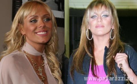 Юлия Началова испортила лицо? Юлия Началова испортила лицо?