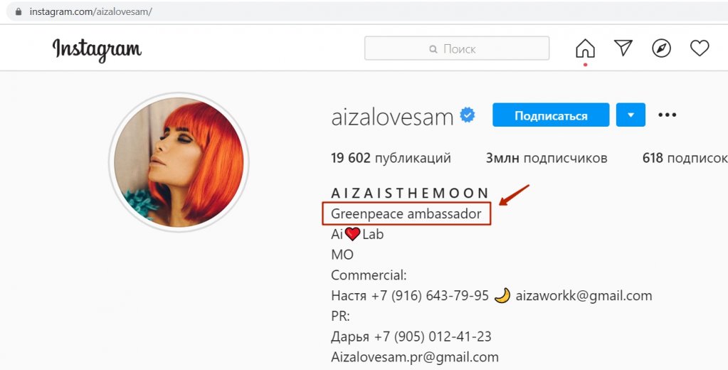 Айза Анохина пластик 