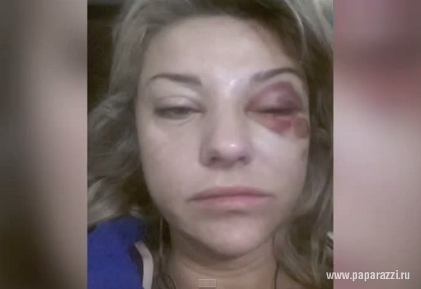 Жене Марата Башарова Екатерине Архаровой требуется помощь врачей