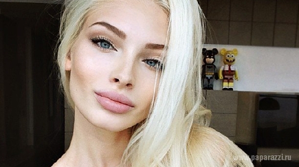 В сеть попало фото Алены Шишковой до пластических операций