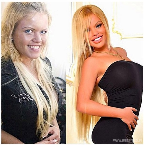Страшно красивые: 5 девушек, которые стали популярны благодаря фотошопу и пластическим операциям - Олеся Малибу (до и после пластики)