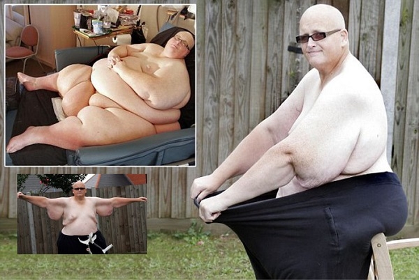 Британец расстался с девушкой, ради которой похудел на 300 килограммов