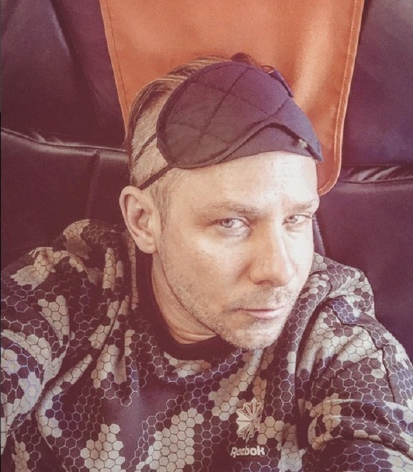Поклонники Мити Фомина обеспокоены его внешним видом