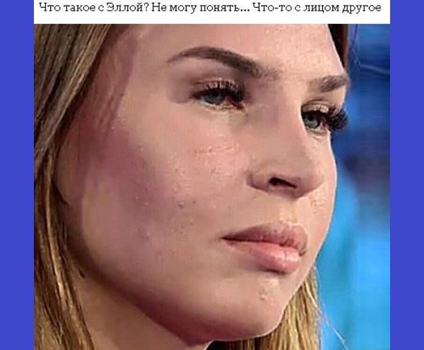 Элла Суханова ужаснула состоянием кожи на своем лице