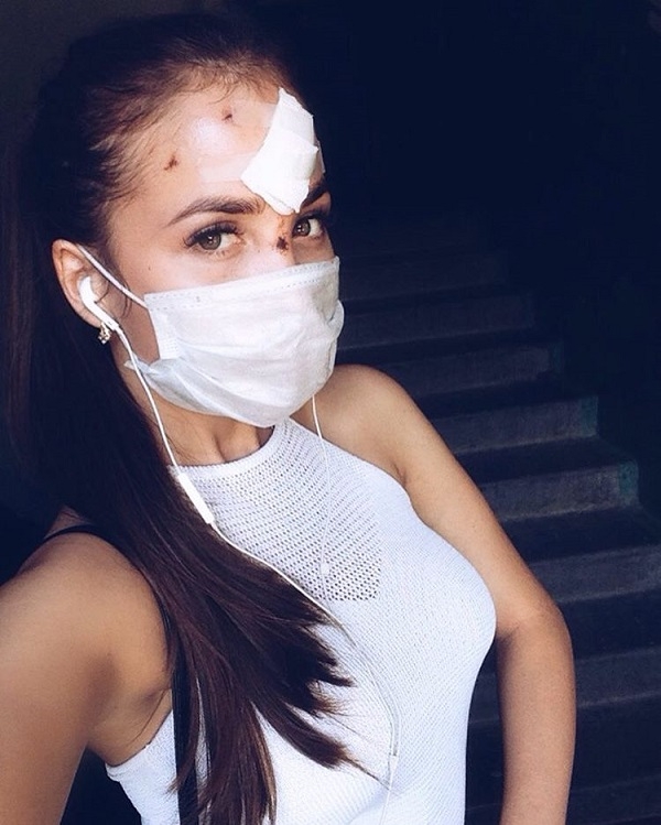 Победительница Miss Sensation 2016 Кристина Ананьева опубликовала снимки изувеченного лица