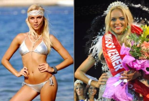 Певица Ханна неудачно перекачала губы