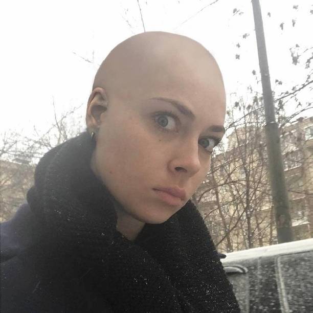 Настасья Самбурская шокировала поклонников, побрившись налысо
