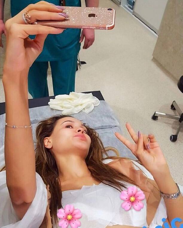После коррекции груди Анна Калашникова принялась исправлять свое лицо