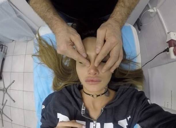 Марина Мексика ужаснула видео из кабинета пластического хирурга
