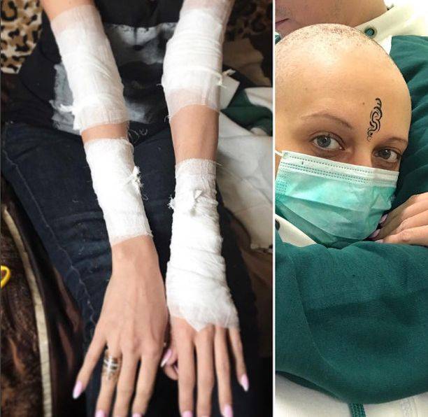 Лама Сафонова рассказала о болезненном уколе, который спасает от рака