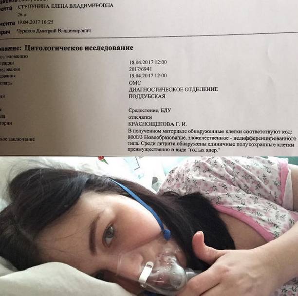 У Елены Степуниной диагностировали рак груди