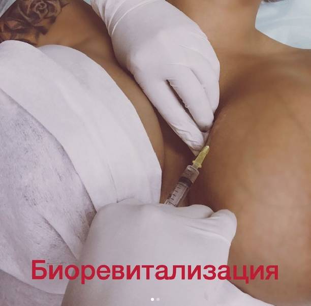 Маргарита Керн делает уколы в грудь восьмого размера