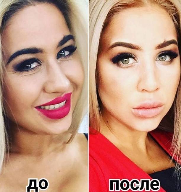 Мария Кохно шокировала состоянием анорексичного тела