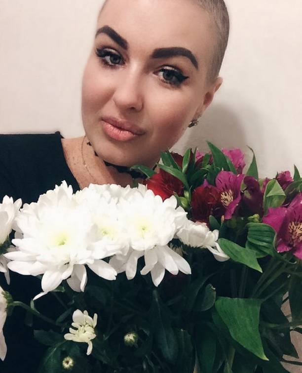 Поборовшая рак Елена Степунина не может привыкнуть к своей новой внешности
