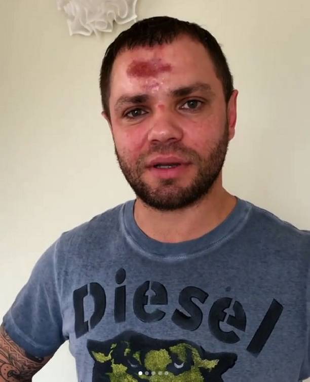 Роман Пашков из группы "Градусы" чудом избежал серьезных травм в аварии
