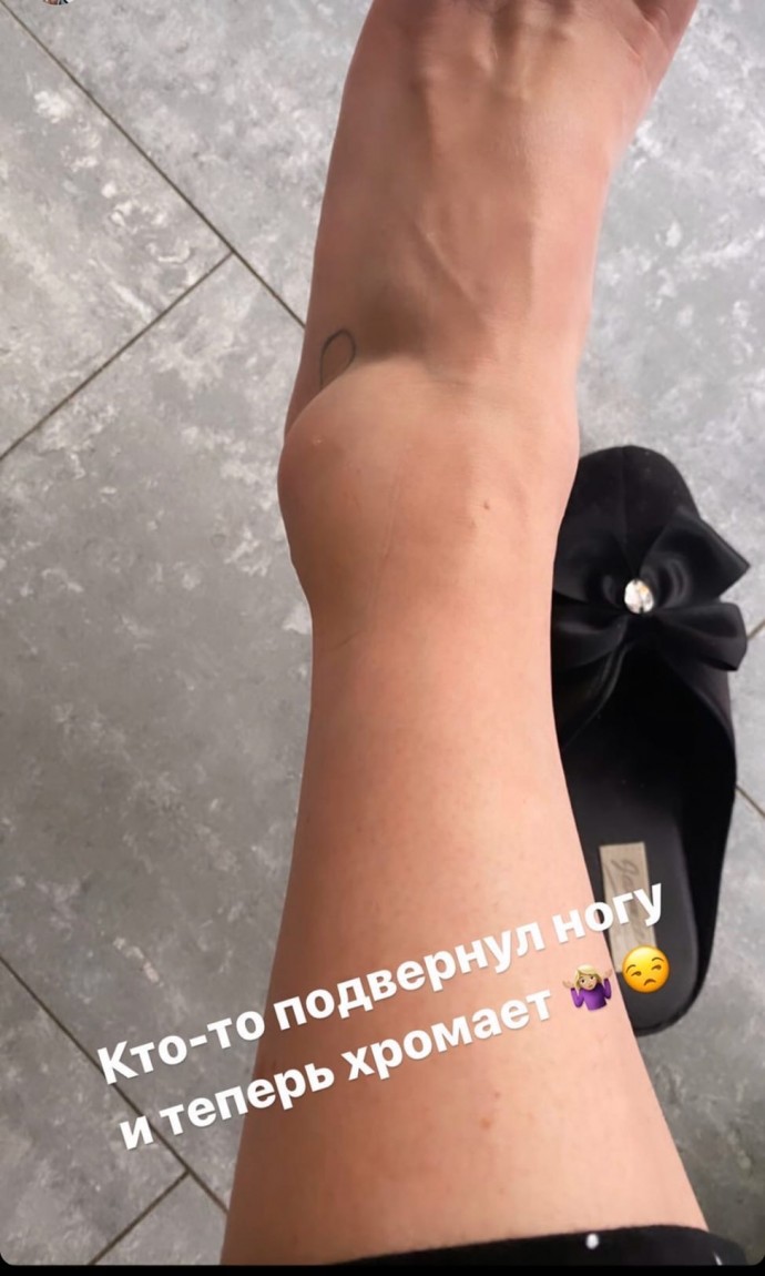 Анна Семенович получила травму
