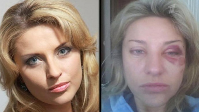 Одна из избитых жен Марата Башарова написала на него заявление в полицию