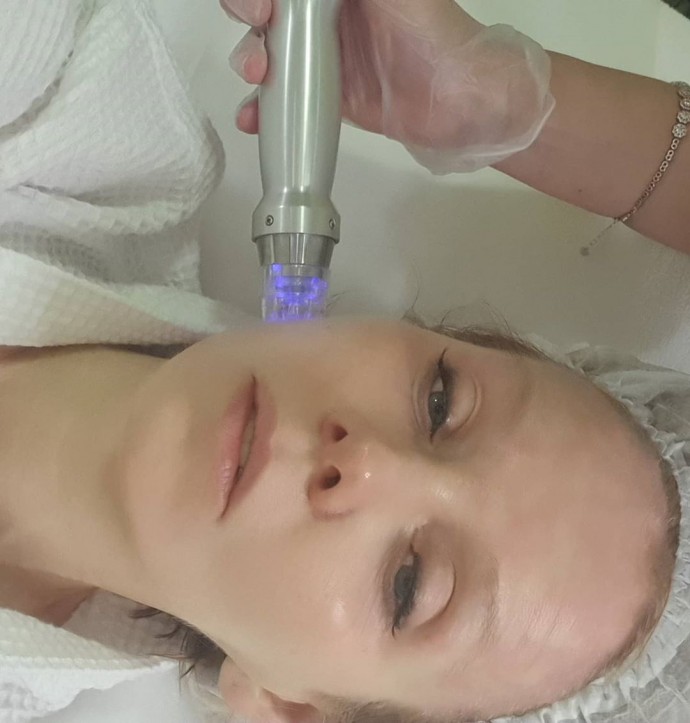 Валерия показала на что она готова ради красоты, несмотря на боль