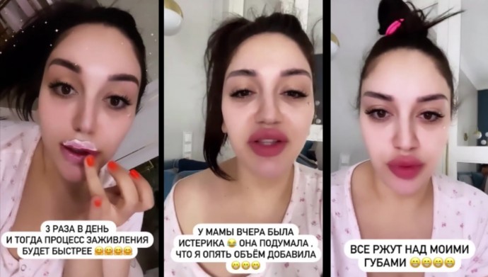 "Очередной вареник": Гоар Аветисян, сама не ожидая того, увеличила губы