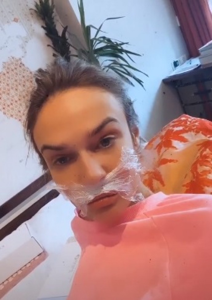 Алёна Водонаева призналась, что у неё растут усы и борода