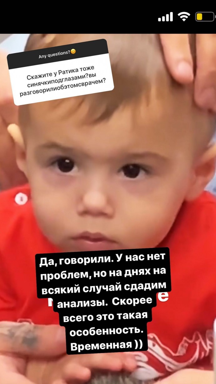 Анастасия Решетова объяснила, откуда у ее сына синяки под глазами