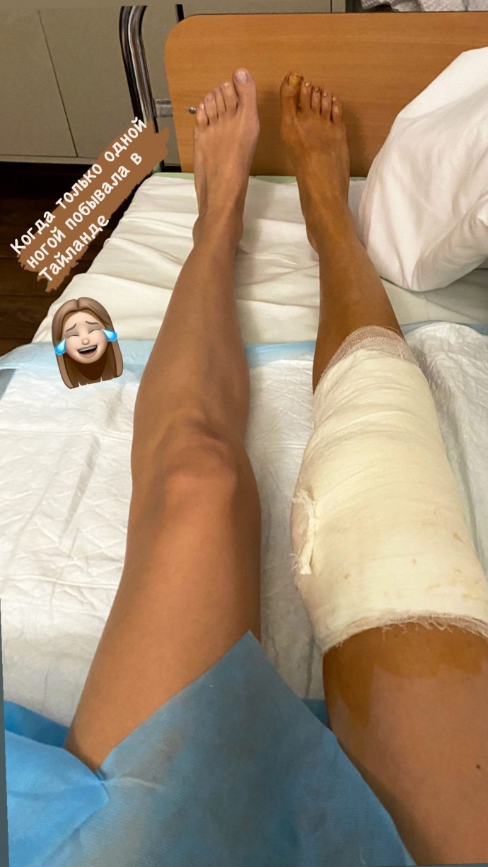Евгения Лоза сообщила об операции на колене