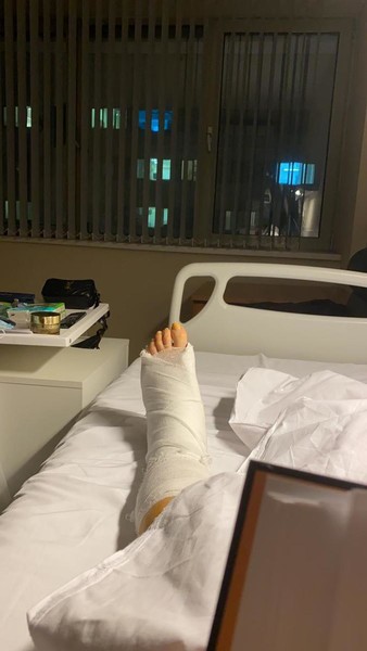 Участница шоу "Уральские пельмени" Илана Юрьева попала на операционный стол после катания на лыжах