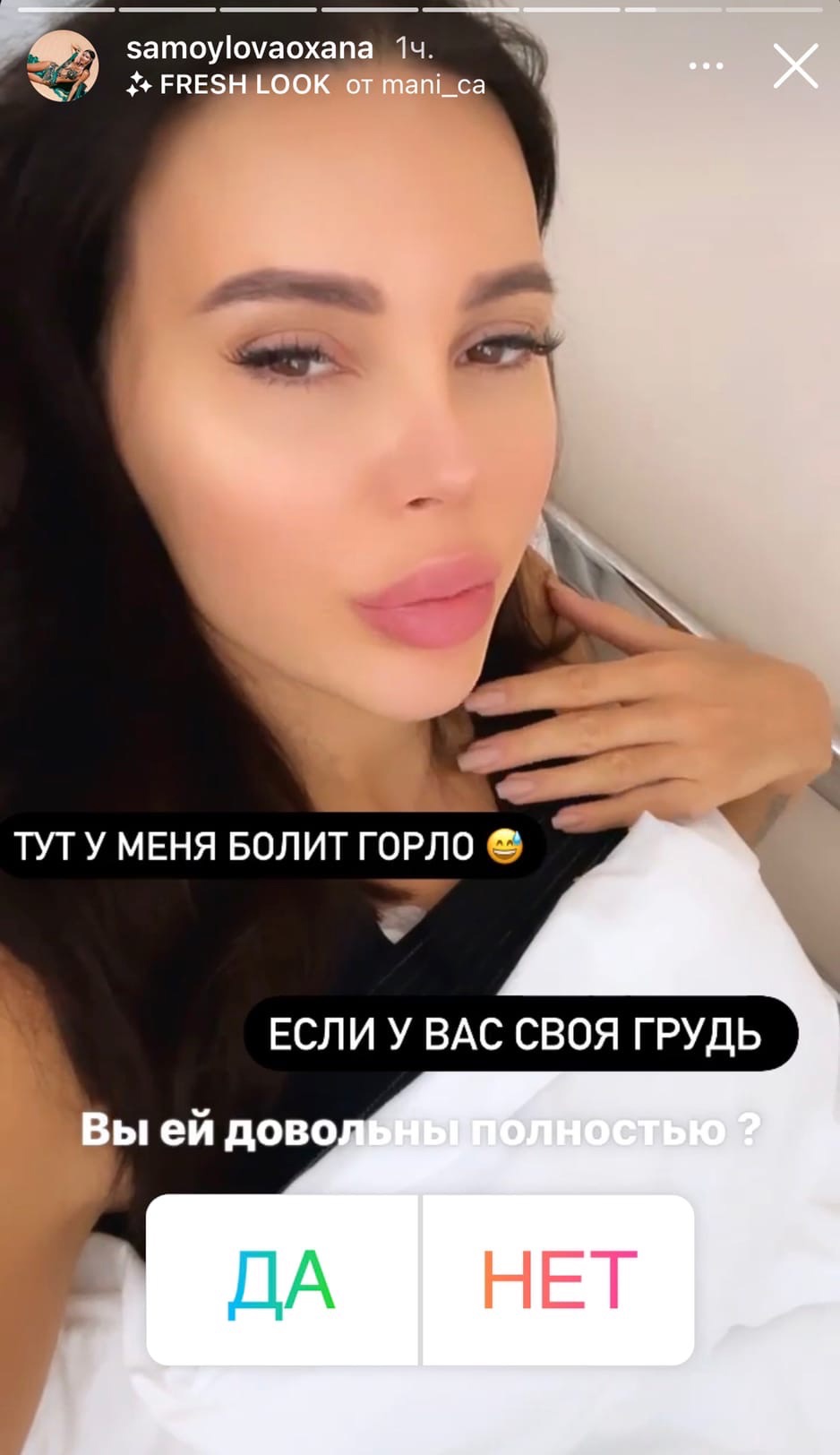Оксана Самойлова сделала пластическую операцию
