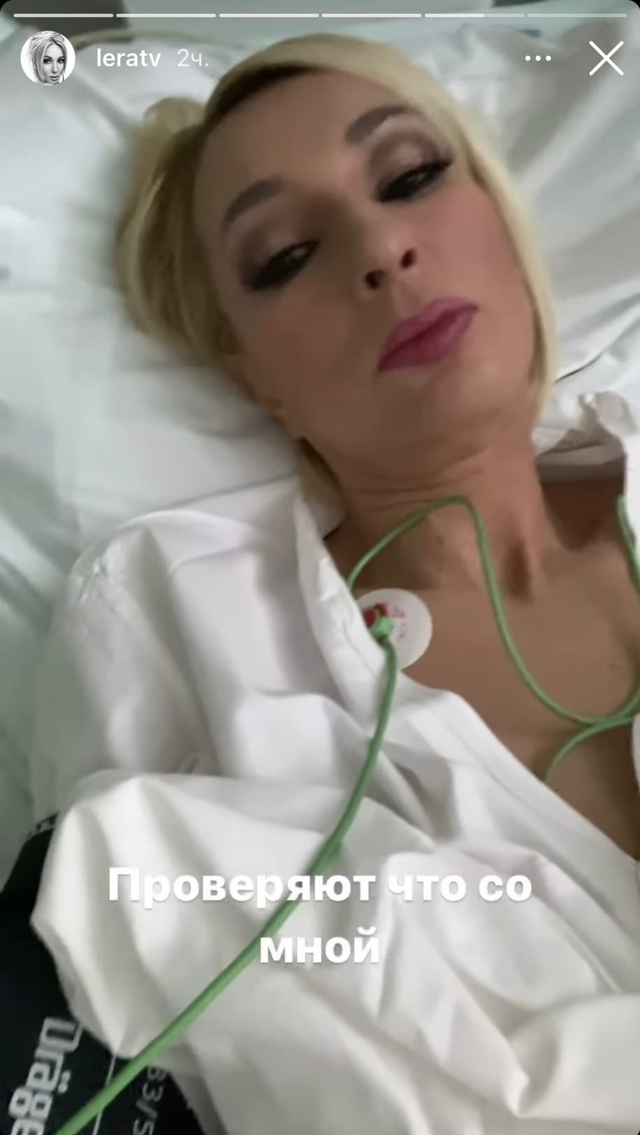 "Инфаркт миокарда": госпитализированная Лера Кудрявцева рассказала о том, что с ней произошло