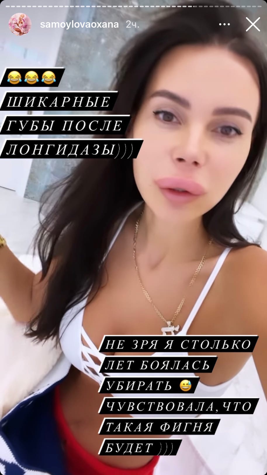 "Слабонервным не смотреть": Оксана Самойлова ужаснула огромными губами
