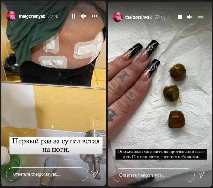 Очнувшись после операции бьюти-блогер, предпочитающий носить женские платья, Игорь Синяк решил, что пора худеть