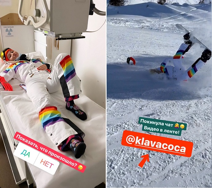 The morning after the party with Olga Buzova, Klava Koka was hospitalized